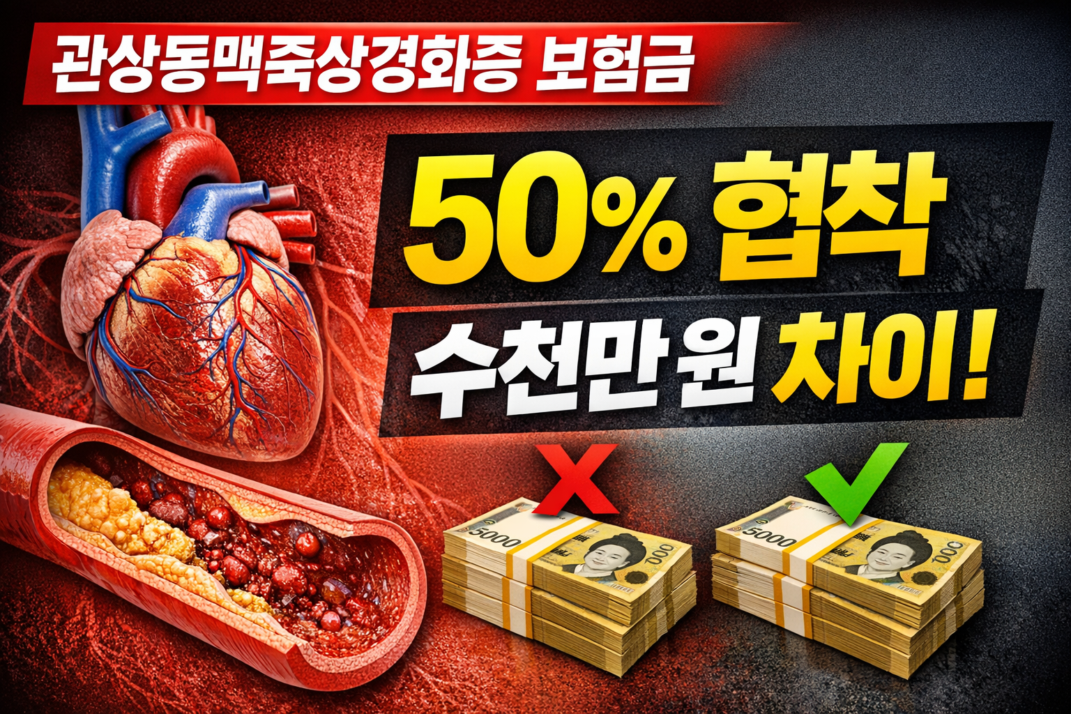 관상동맥죽상경화증 보험금 50% 협착 기준