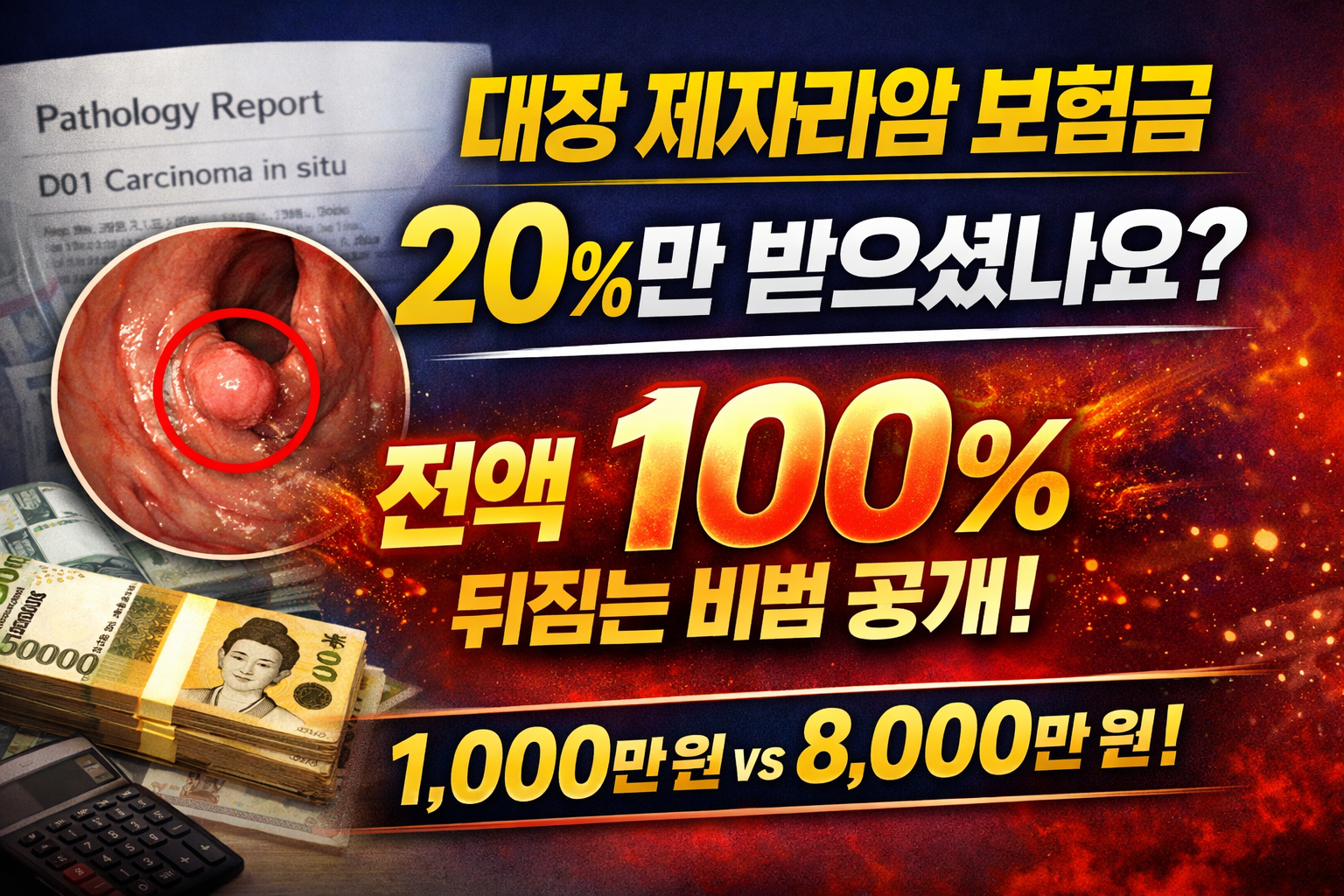 대장 제자리암 보험금 D01 코드 20% 지급과 100% 전액 수령 차이 설명 이미지