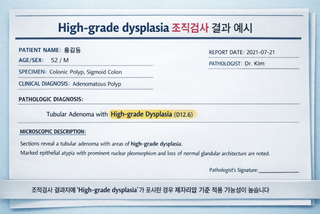 대장 선종 D12.6 보험금 병리보고서 High-grade dysplasia 예시