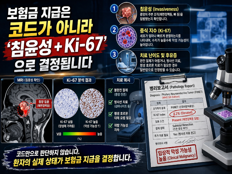 Ki-67 지수와 종양 침윤성 설명 의료 이미지