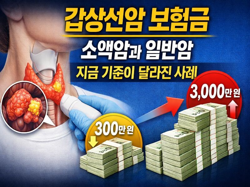 갑상선암 보험금 소액암과 일반암 지급 차이 비교 사례 이미지