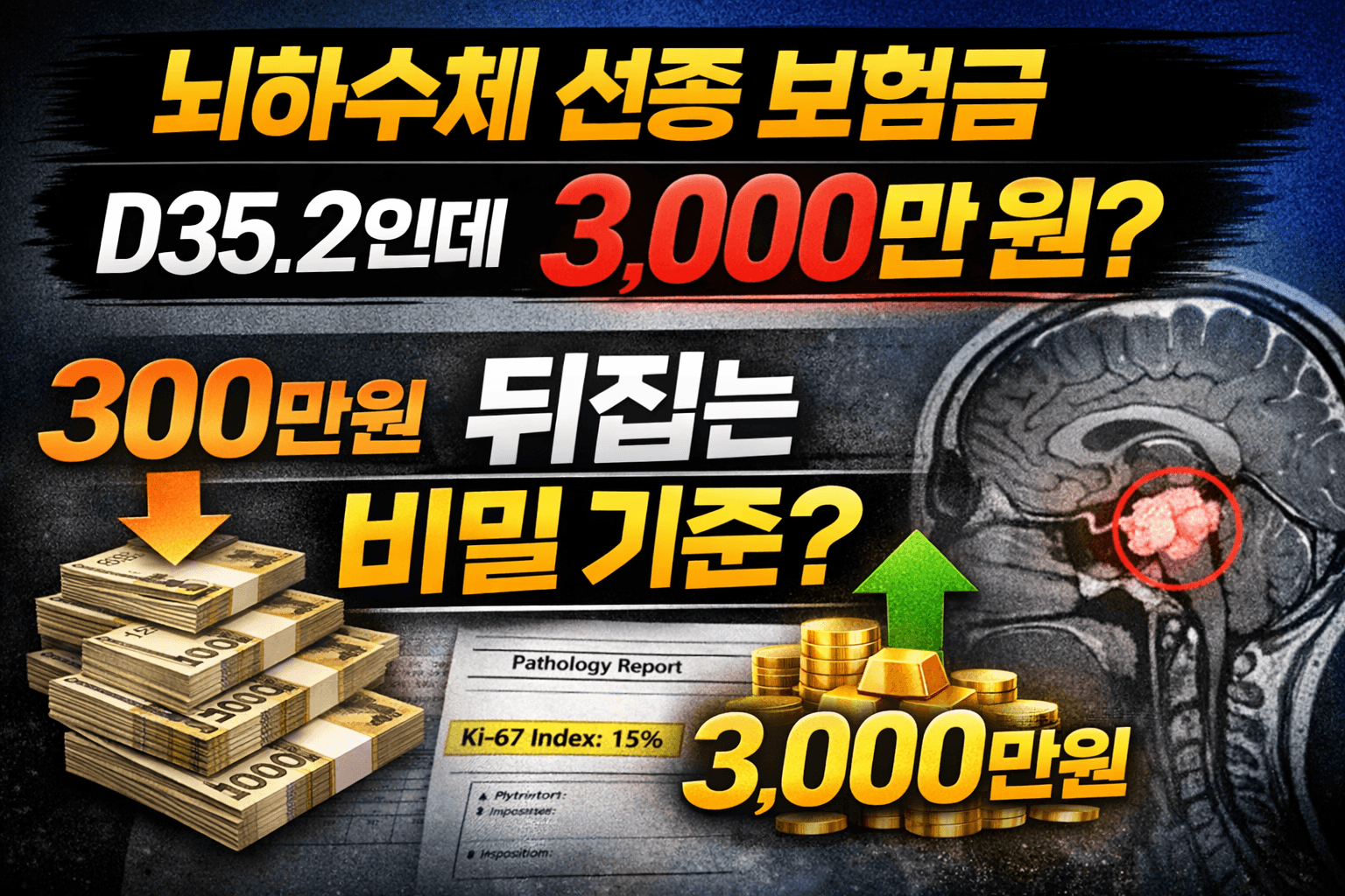 뇌하수체 선종 보험금 D35.2인데도 3000만원 가능 여부와 소액암 뒤집는 기준 설명