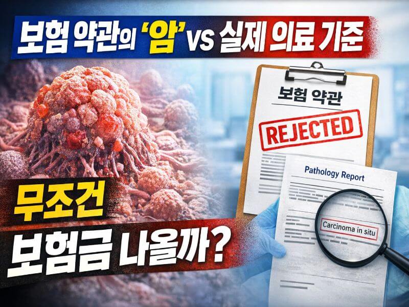 보험 약관 암 정의와 실제 의료 기준 차이로 보험금 지급 여부가 달라지는 구조 설명 이미지