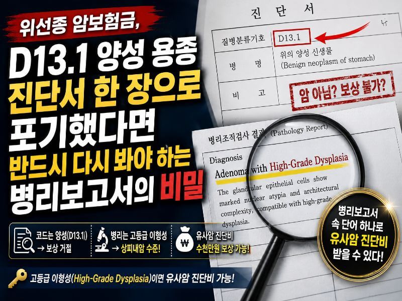 위선종 암보험금 D13.1 진단서와 병리보고서 속 High-Grade Dysplasia 고등급 이형성증으로 유사암 진단비 가능성을 설명하는 이미지
