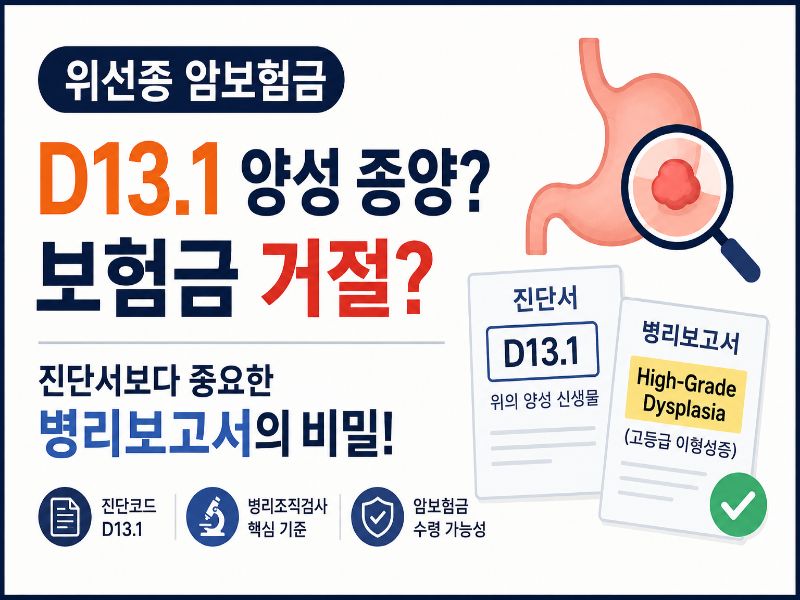 위선종 암보험금 D13.1 진단서와 병리보고서 속 High-Grade Dysplasia 고등급 이형성증으로 유사암 진단비 가능성을 설명하는 이미지