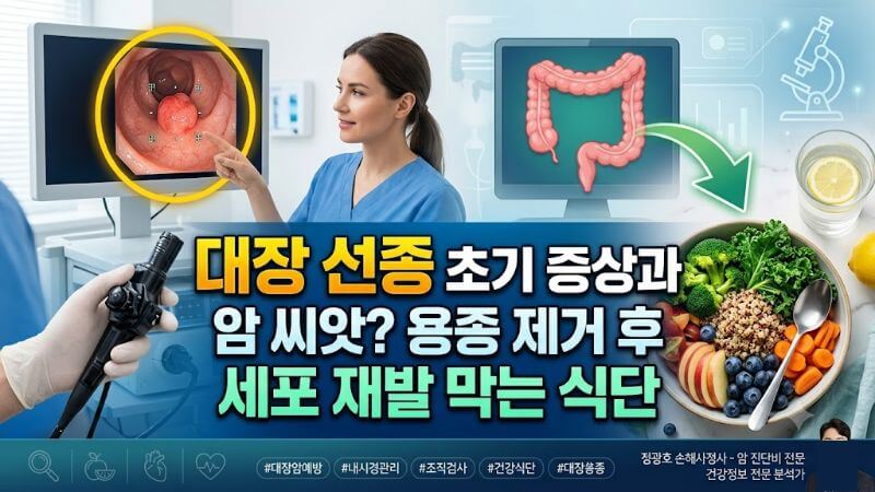 대장내시경 검사 중 발견된 대장 선종 조직과 건강한 채소 식단이 함께 놓인 모습